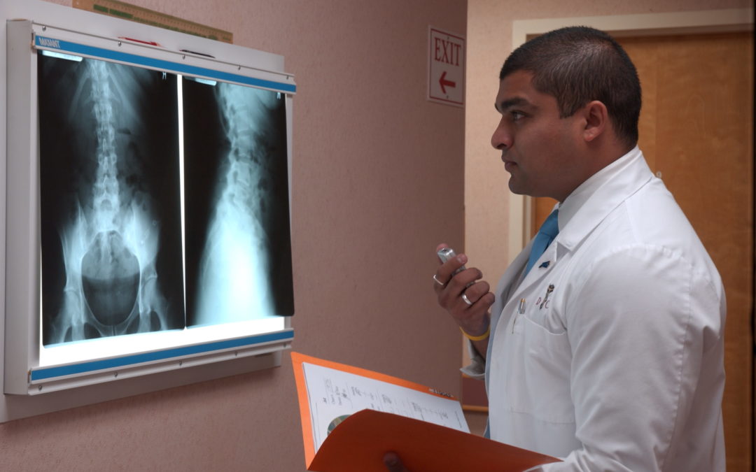 Top Charlotte chiropractor in Charlotte NC offers advice to osteoporosis about treatment